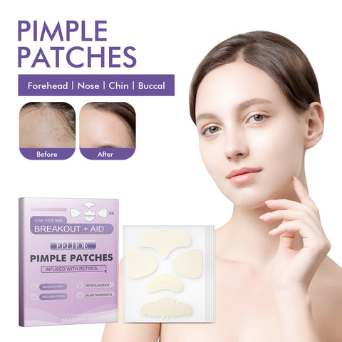 Cheek Acne Patch Anti-acne Smallpox Diluting Acne