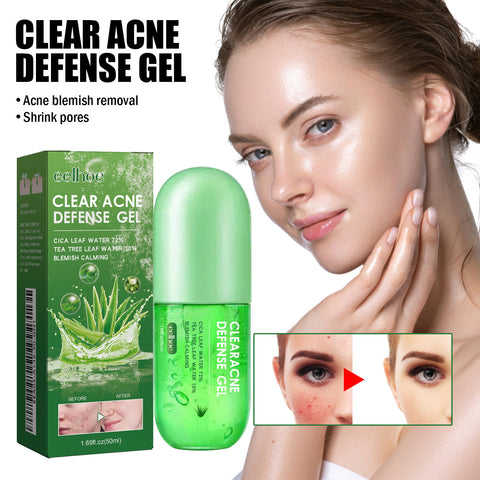 Acne Care Gel Reduces Acne