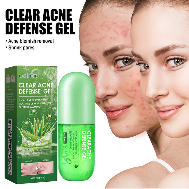 Acne Care Gel Reduces Acne