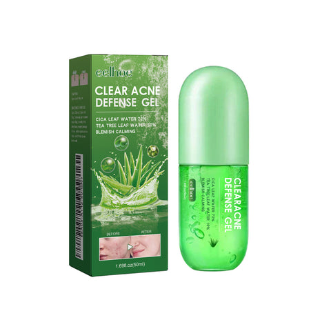 Acne Care Gel Reduces Acne